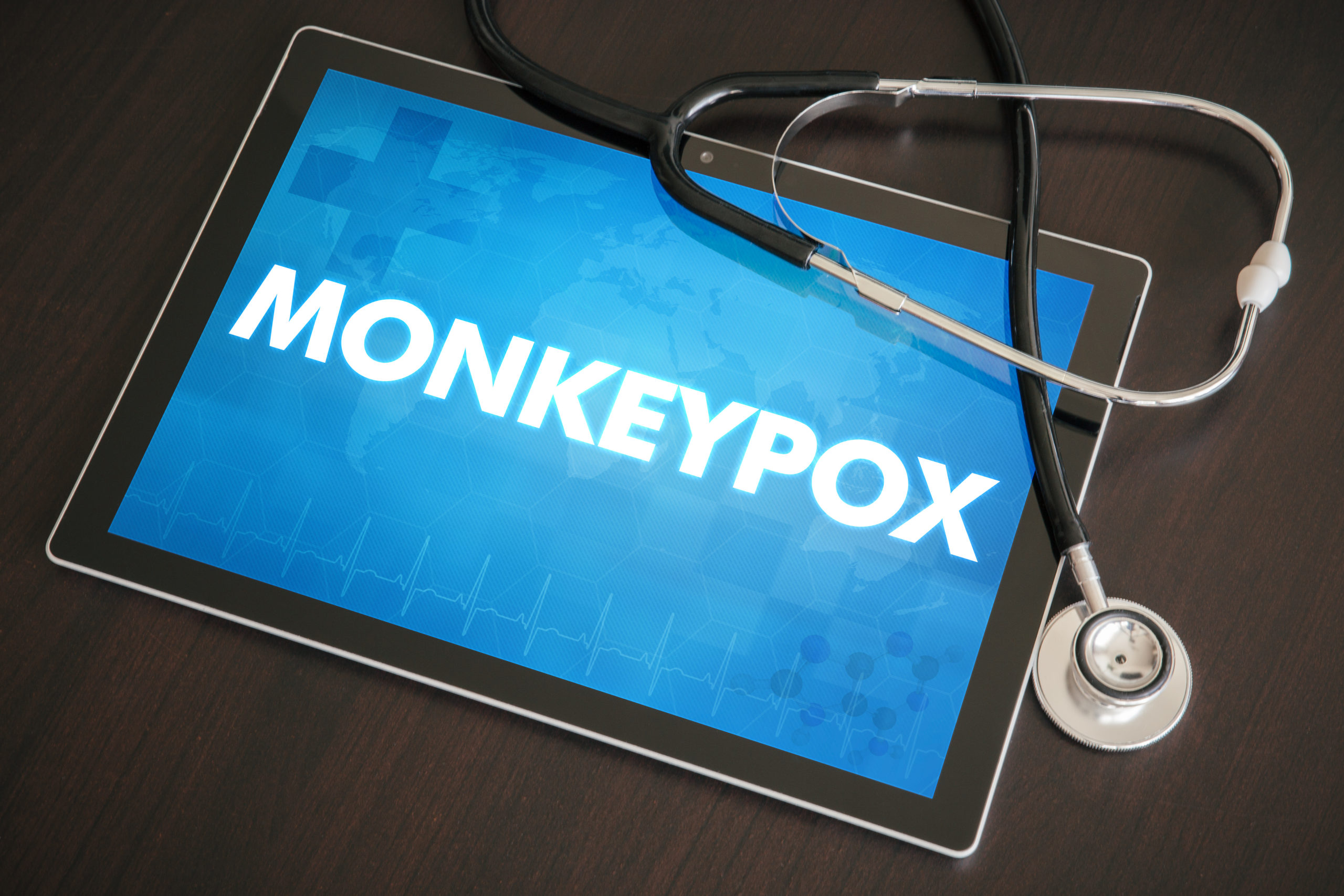 "Monkeypox" on an iPad screen with a stethoscope next to it
